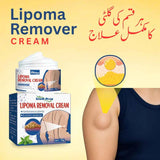 abs South Moon Lipoma Removal Cream